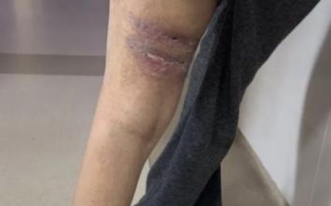 15岁女孩在成都一KTV陪酒坠楼致残，3人被判刑，母亲：赔偿款一直没收到