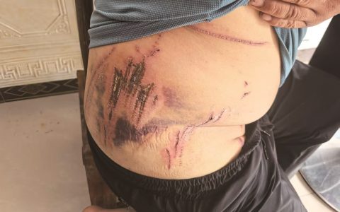 村民山上劳作时被老虎袭击抓伤？ 鹤峰通报：未发现老虎活动痕迹