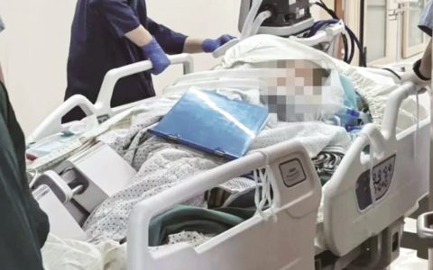 女子踩到氢氟酸中毒身亡 医生：1到2克可致命，误触应及时就医