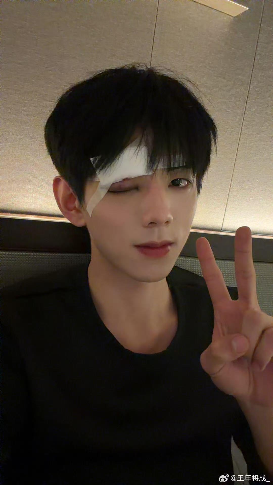 演员王年将成拍短剧时被误伤眼部，剧组和对手戏演员均发文致歉