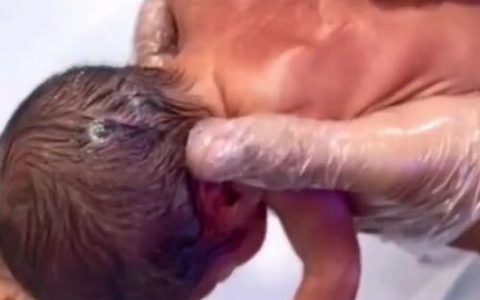 宝宝带“壳”出生！这项新技术为早产儿护航