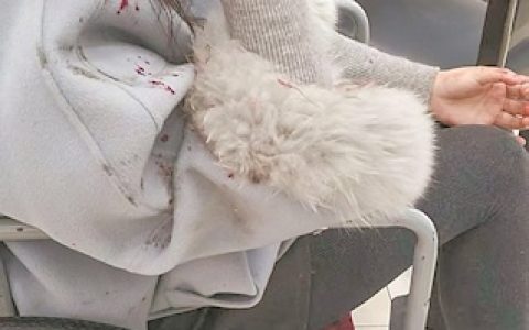 女子遭遇无接触交通事故，血流不止意识模糊 “蓝制服”冲上前一把抱起送医化险