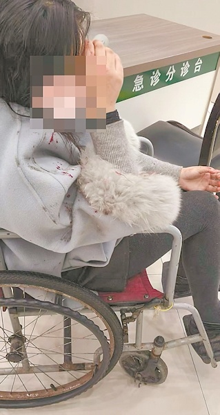 女子遭遇无接触交通事故，血流不止意识模糊 “蓝制服”冲上前一把抱起送医化险