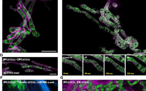 武汉光电国家研究中心张玉慧团队合作提出通过开源锁相SIM超分辨成像技术解析细胞器超微结构