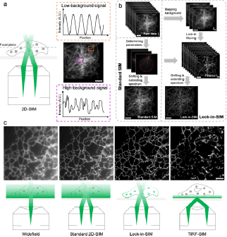 武汉光电国家研究中心张玉慧团队合作提出通过开源锁相SIM超分辨成像技术解析细胞器超微结构