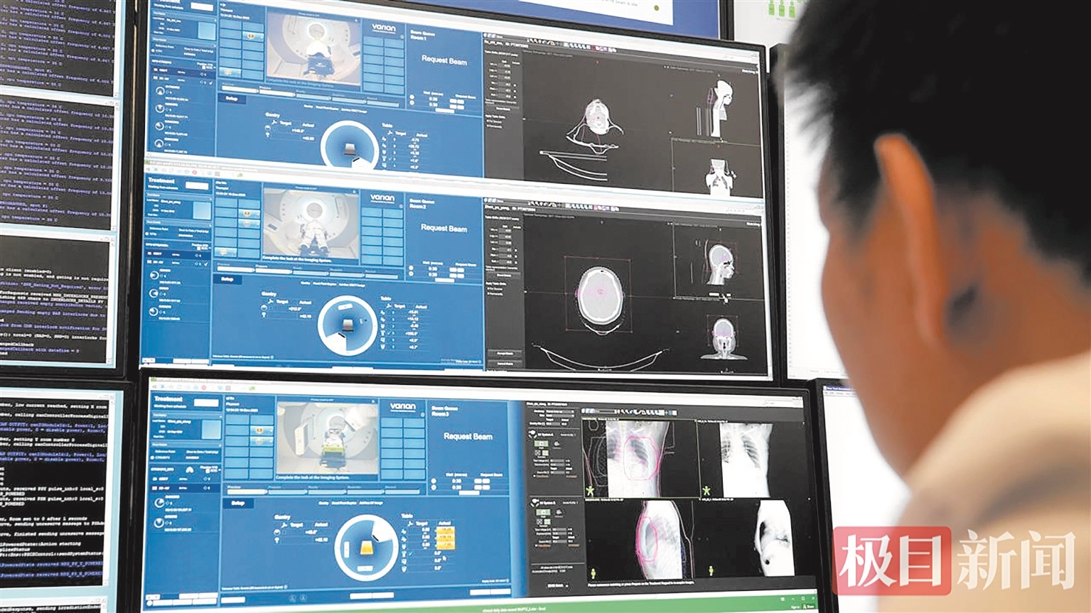 最强“质子刀”在武汉启动 全国首台！三舱同开定点爆破肿瘤