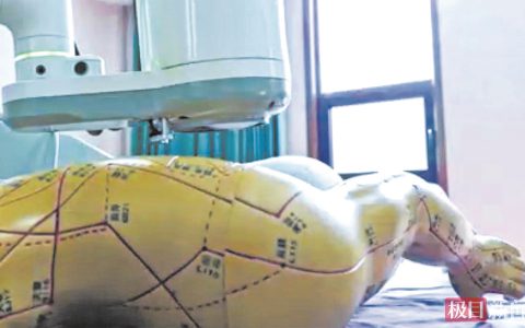 全球首台六轴智能艾灸机器人问世 穴位自动识别误差≤1.82mm