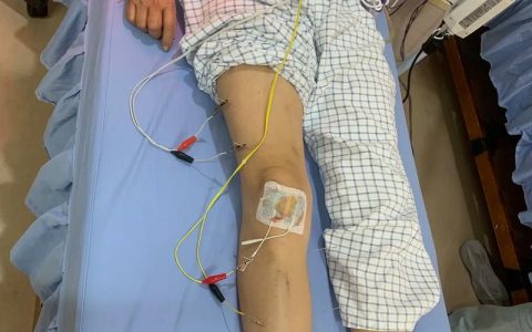 多学科协作“点亮”脑出血术后患者康复之光