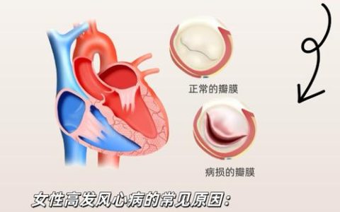 从“心头病”到“新风尚”