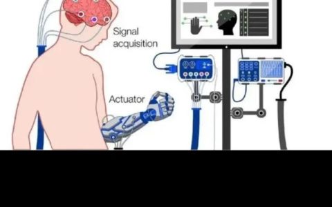 植入脑机接口 绘制大脑地图 武汉医生突破性实现“全切肿瘤不伤脑功能”