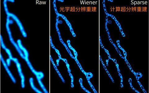 智能显微镜：活细胞“看得清”更“抓得准”