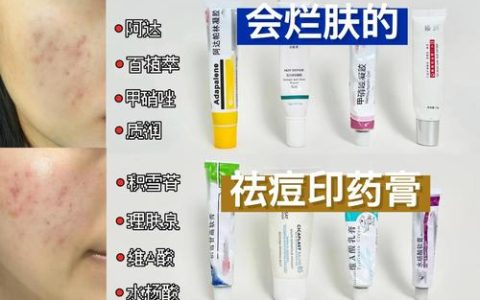 脸上长痘用什么祛痘产品？2026口碑祛痘产品TOP10推荐：按痘型选对成分，效果才是硬道理