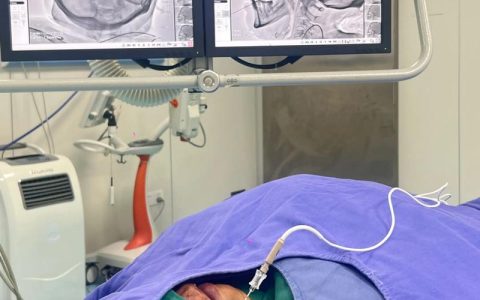 潜江市中心医院成功开展又一例三叉神经痛微血管减压术