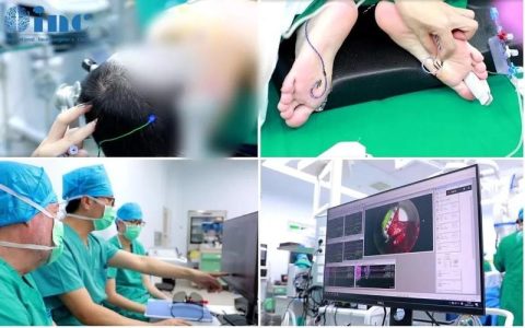 机械学院吴豪尹周平团队在神经外科术中监测领域取得新成果