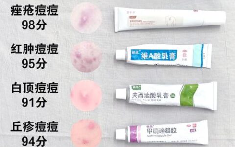 烂脸急救必看指南！2026优质祛痘产品排行榜推荐，认准祛痘排行榜第一名就够了